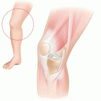 膝の関節（滑膜）